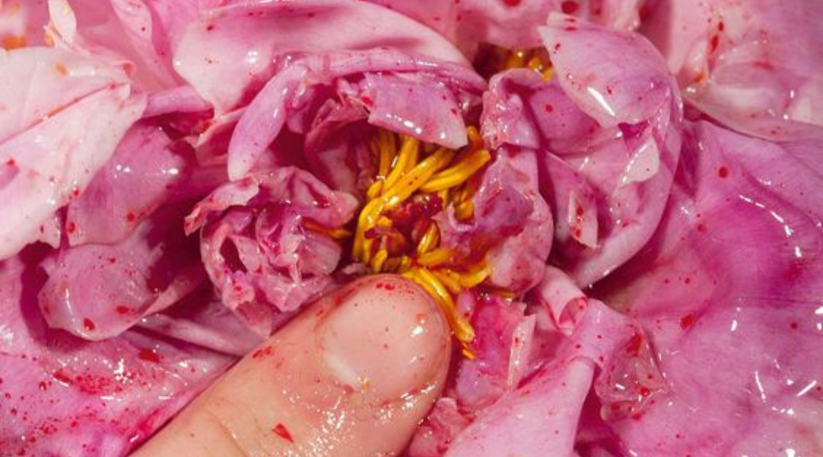 5 Ways That Stress Can Impact Your Menstrual Cycle